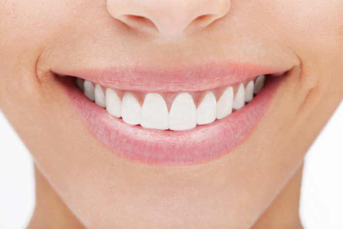 We offer professional teeth whitening in buford, GA