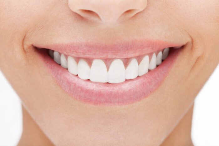 We offer professional teeth whitening in buford, GA