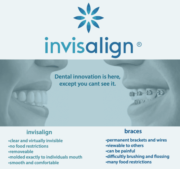 Affordable Invisalign in Buford, Georgia