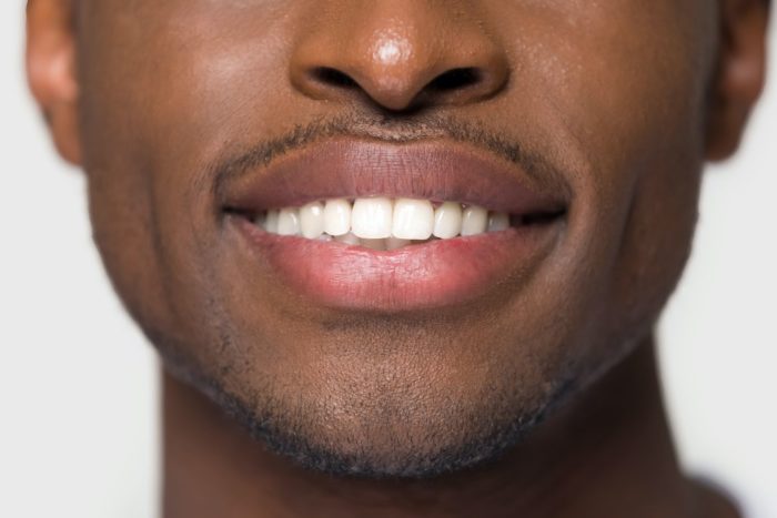 teeth whitening dentist buford ga