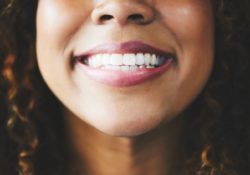 cosmetic teeth whitening Buford Georgia