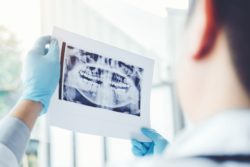 dental imaging x-ray of teeth
