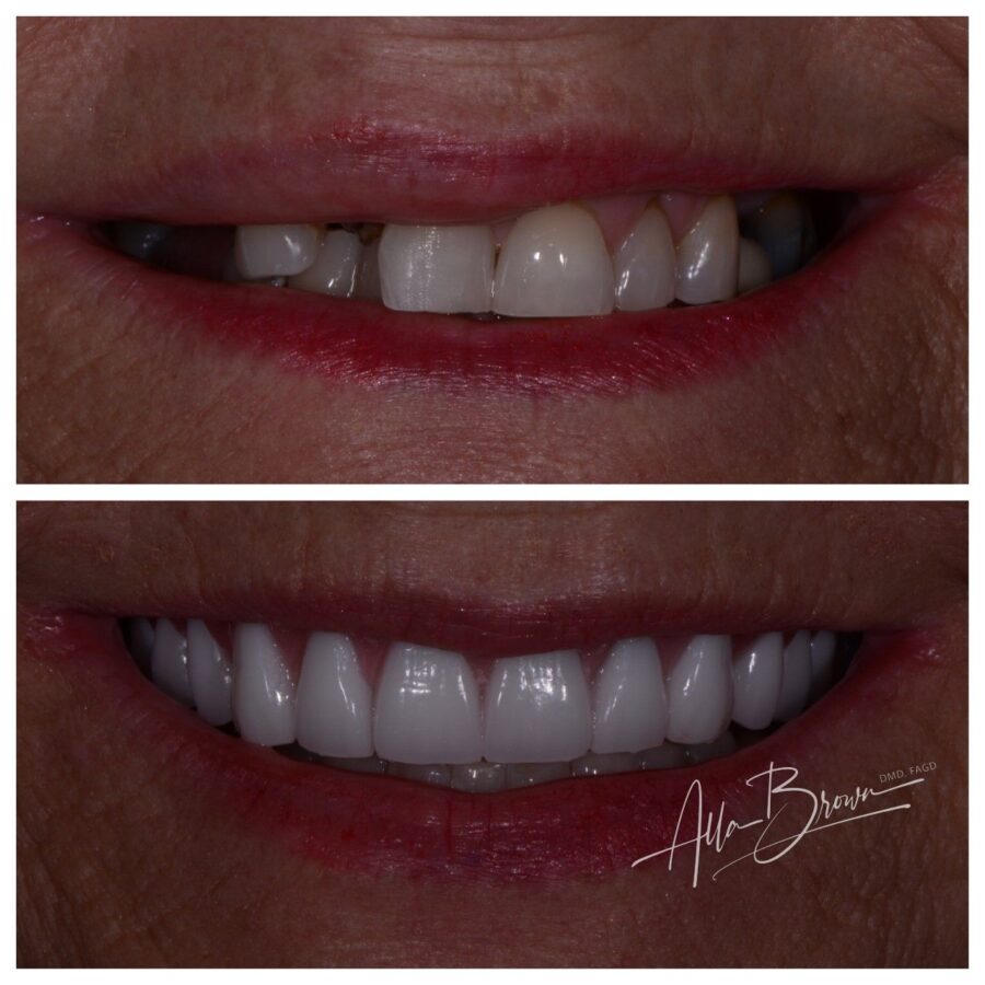 Main Gallery Image 3 | Denture Cases