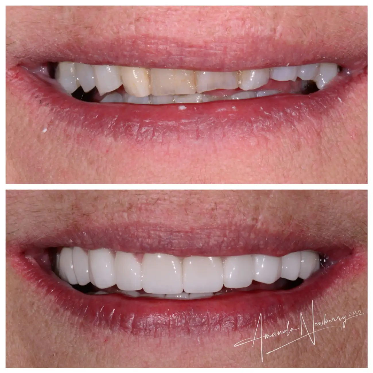 Patient Before After