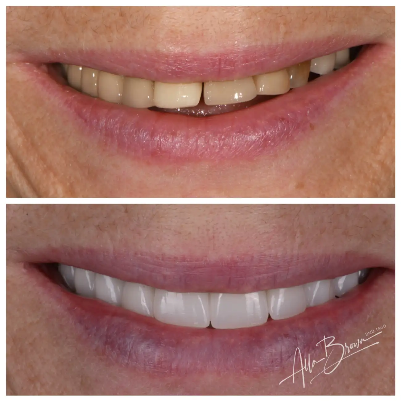 Patient Before After