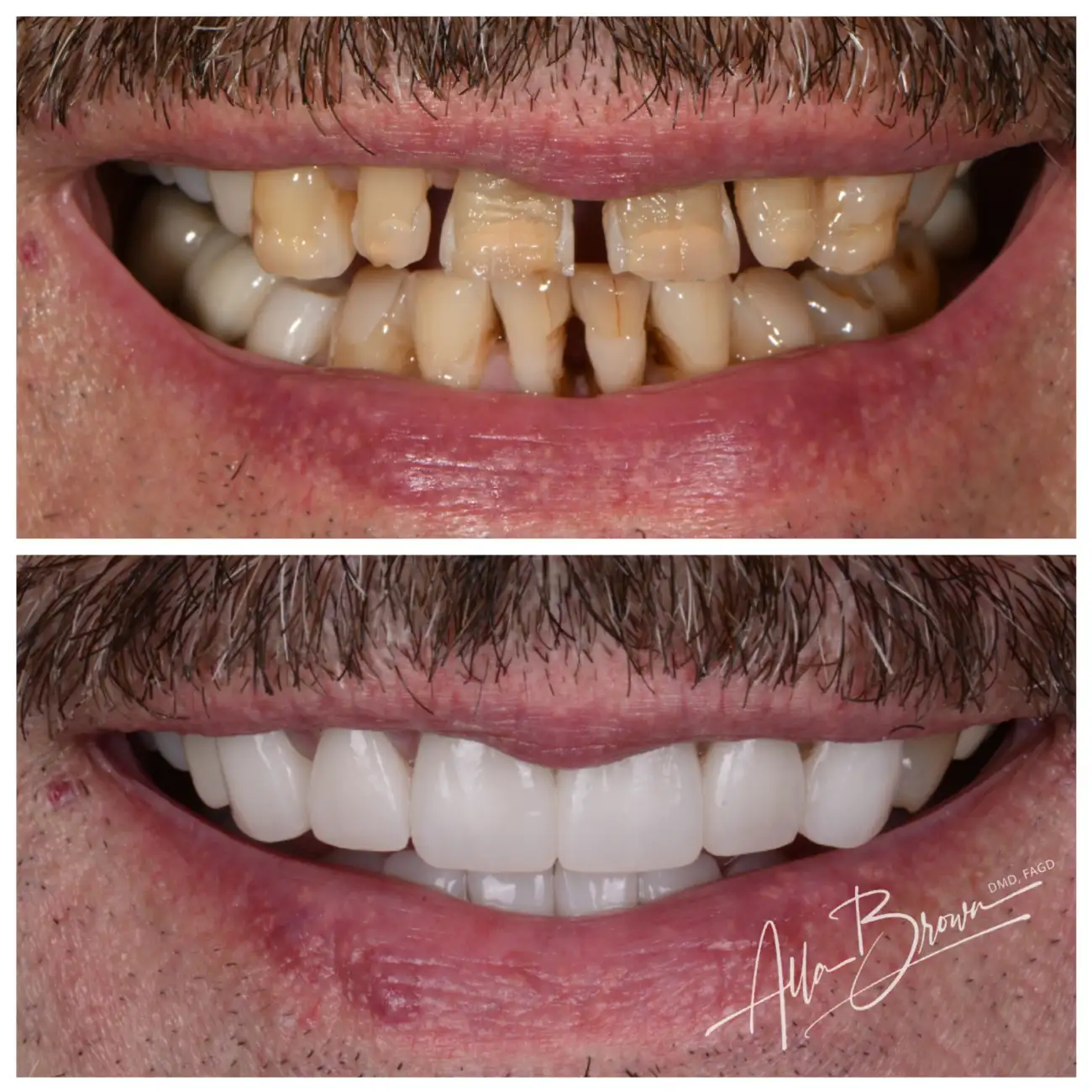 Patient Before After