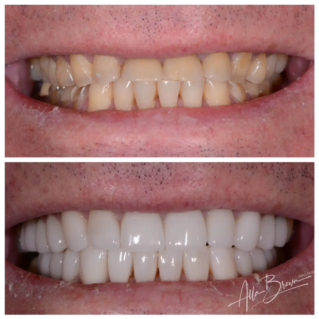 Patient Before After