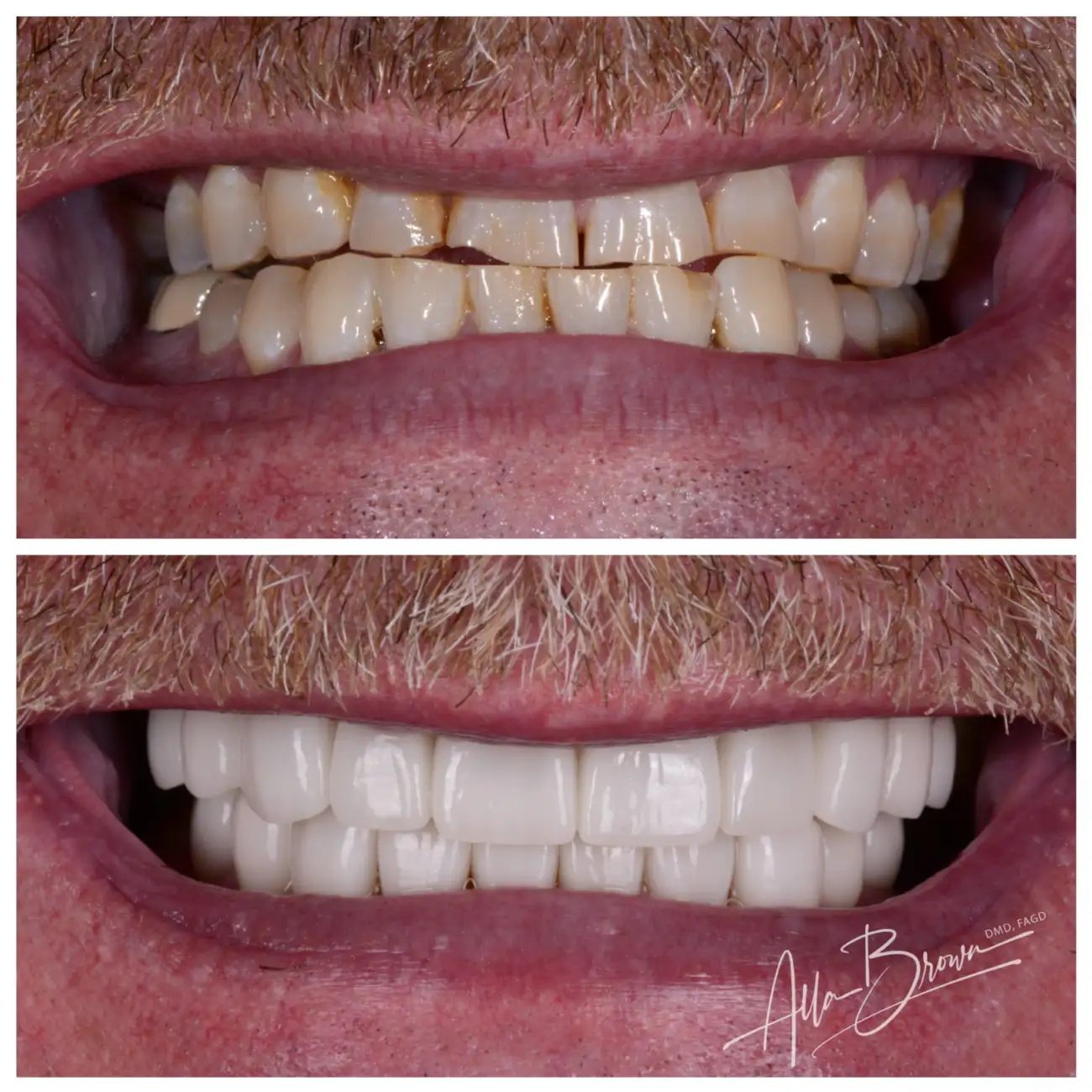 Patient Before After