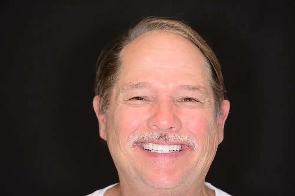 Patient Headshot