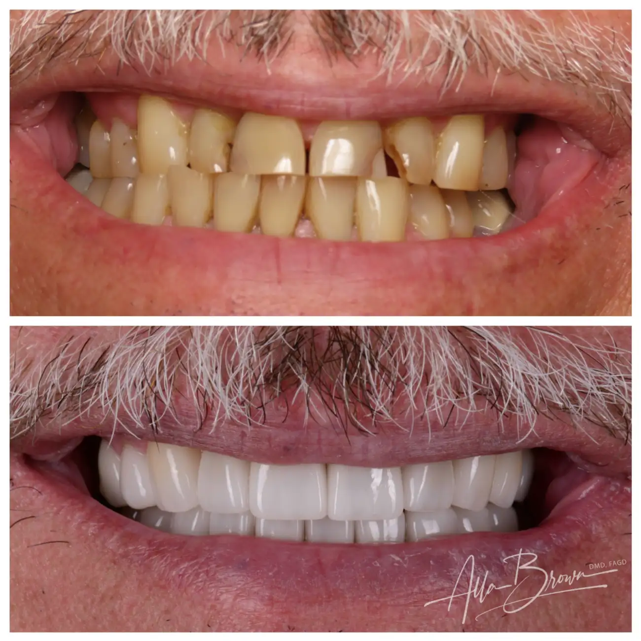 Patient Before After