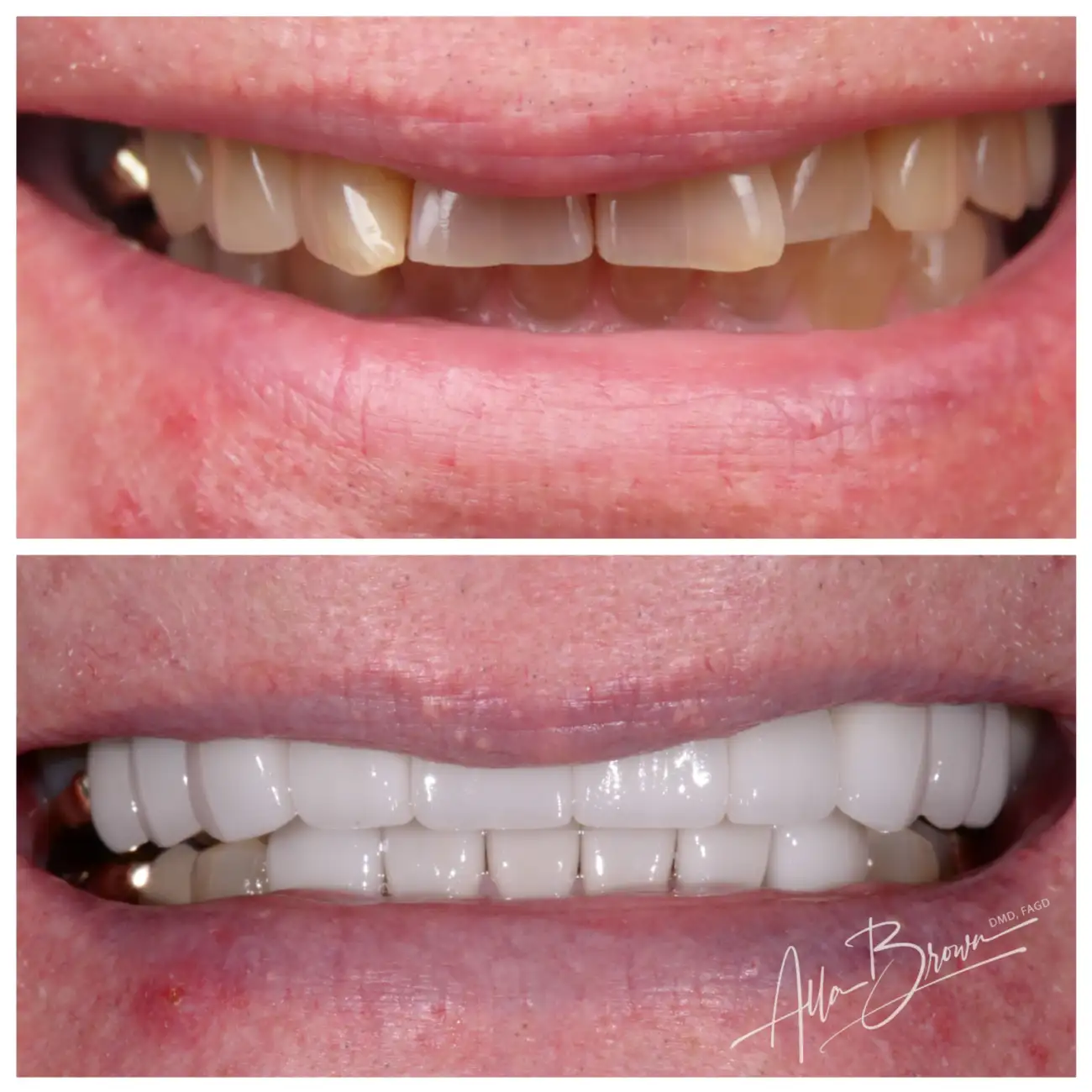 Patient Before After
