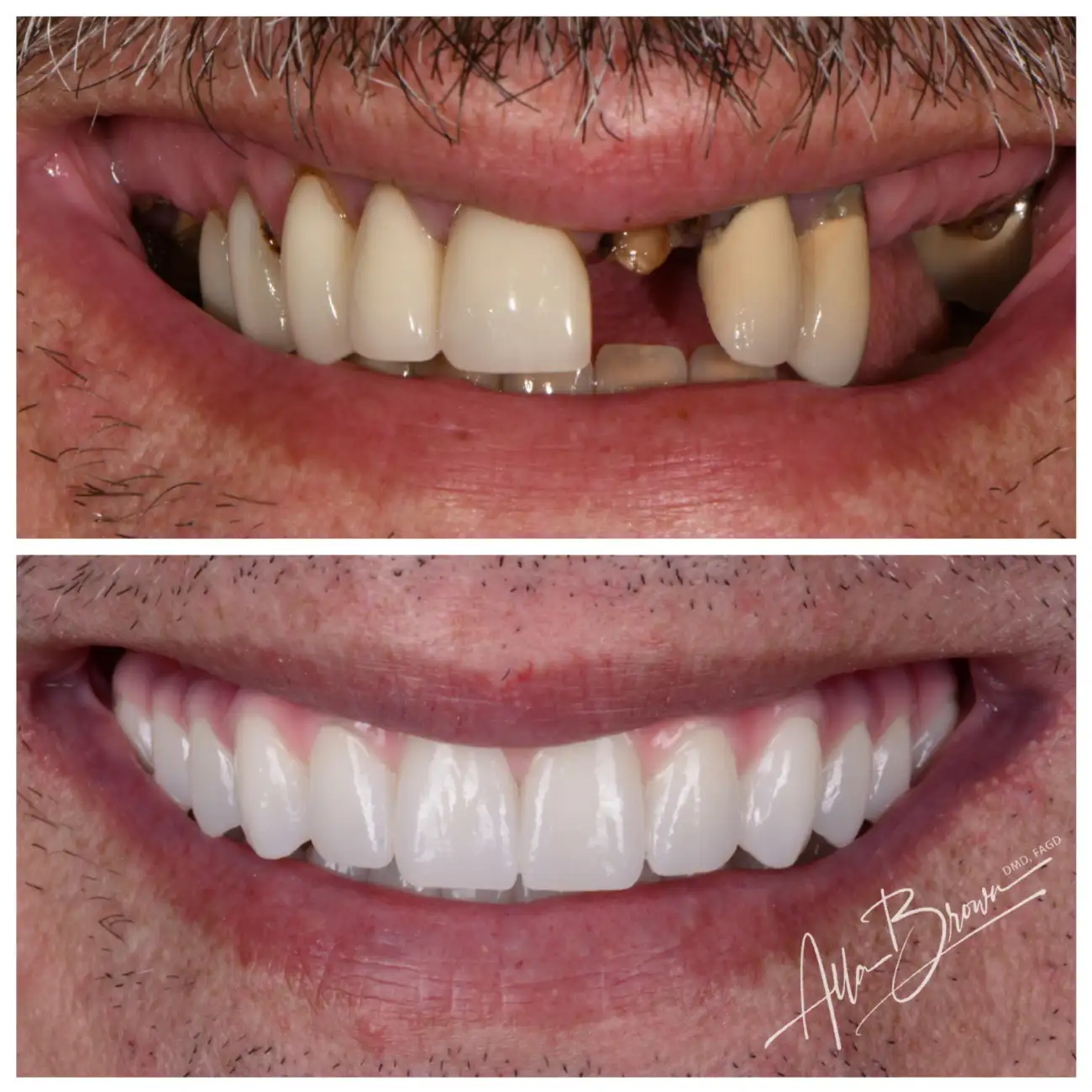 Patient Before After