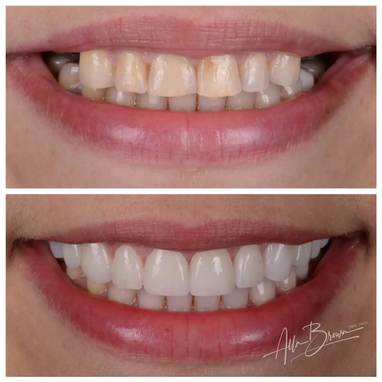 Patient Before After