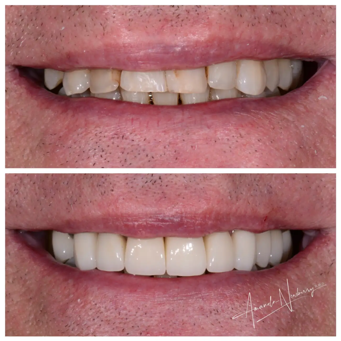 Patient Before After