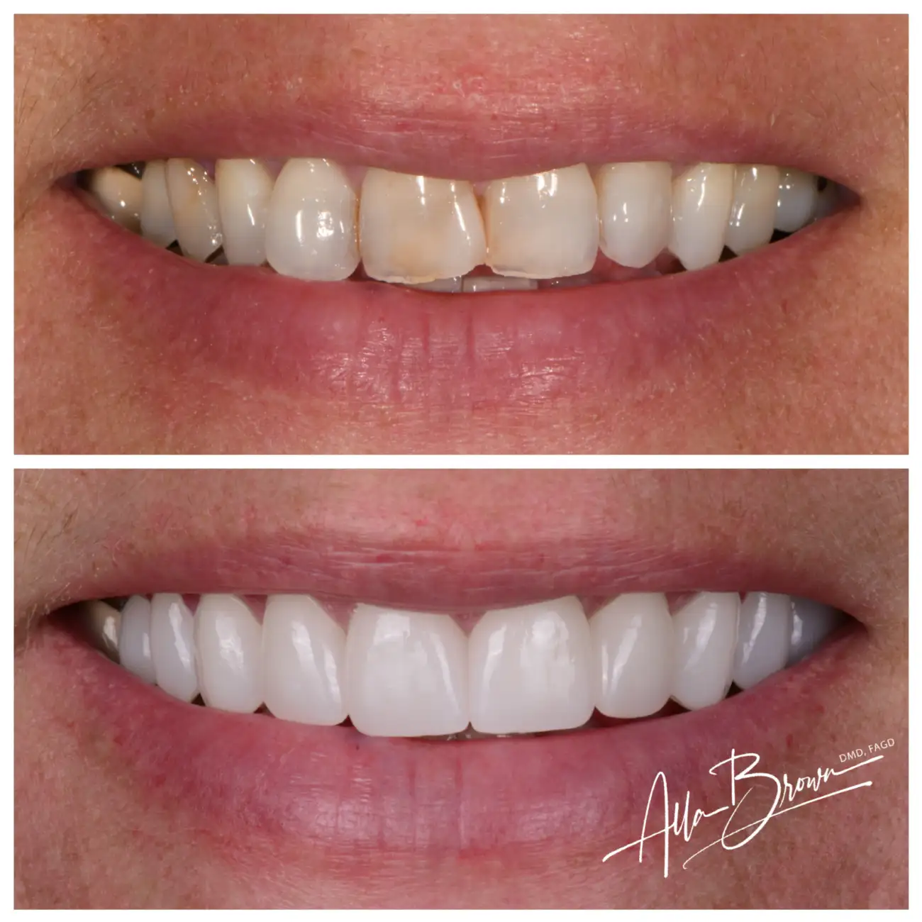 Patient Before After