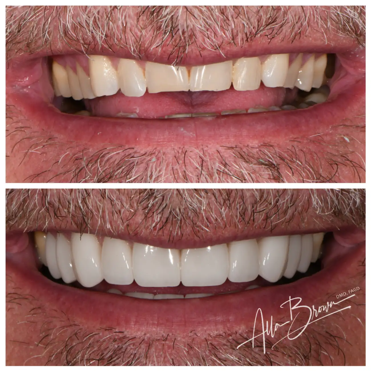 Patient Before After